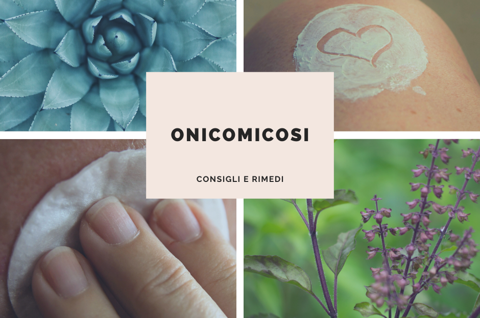 Onicomicosi: consigli e rimedi