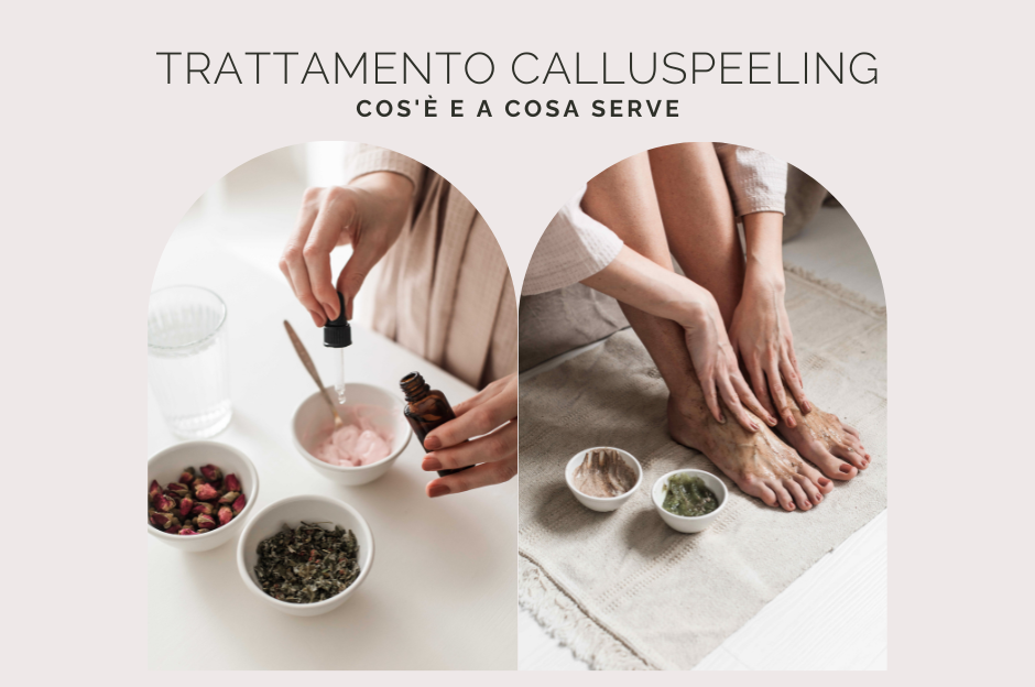 Trattamento Calluspeeling: cos’è e a cosa serve